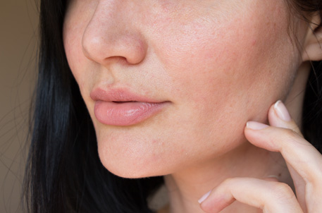 Hyperpigmentation Characteristics and Causes
